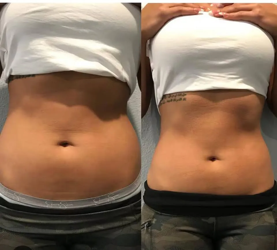 CRYO360 (Boul. Laval #340)